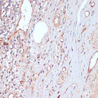 Immunohistochemistry of paraffin-embedded Human appendix using CD34 Polyclonal Antibody at dilution of 1:100 (40x lens) .