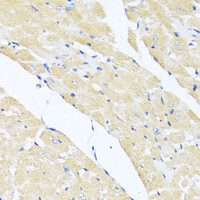 Immunohistochemistry of paraffin-embedded Mouse heart using EIF2S1 Polyclonal Antibody at dilution of 1:100 (40x lens) .