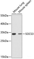 Western blot analysis of extracts of various cell lines using SOCS3 Polyclonal Antibody at dilution of 1:3000.