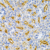 Immunohistochemistry of paraffin-embedded Rat kidney using MYD88 Polyclonal Antibody at dilution of 1:100 (40x lens) .