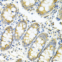 Immunohistochemistry of paraffin-embedded Human colon using MYD88 Polyclonal Antibody at dilution of 1:100 (40x lens) .