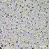 Immunohistochemistry of paraffin-embedded Mouse liver using SKP2 Polyclonal Antibody at dilution of 1:100 (40x lens) .