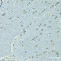 Immunohistochemistry of paraffin-embedded Rat brain using CEBPA Polyclonal Antibody at dilution of 1:100 (40x lens) .