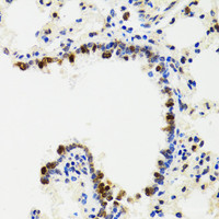 Immunohistochemistry of paraffin-embedded Rat lung using IKBKG Polyclonal Antibody at dilution of 1:100 (40x lens) .