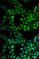 Immunofluorescence analysis of MCF-7 cells using IKBKG Polyclonal Antibody