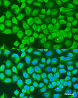 Immunofluorescence analysis of U2OS cells using MAP3K7 Polyclonal Antibody at dilution of 1:100. Blue: DAPI for nuclear staining.