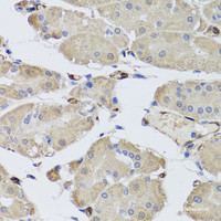 Immunohistochemistry of paraffin-embedded Human stomach using FABP5 Polyclonal Antibody at dilution of 1:100 (40x lens) .