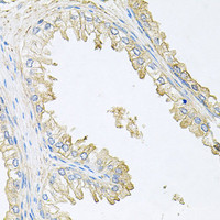 Immunohistochemistry of paraffin-embedded Human prostate using PPP3R1 Polyclonal Antibody at dilution of 1:100 (40x lens) .