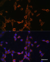 Immunofluorescence analysis of NIH/3T3 cells using PPP3R1 Polyclonal Antibody at dilution of 1:100. Blue: DAPI for nuclear staining.