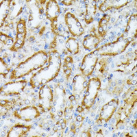 Immunohistochemistry of paraffin-embedded Rat kidney using Caspase-1 Polyclonal Antibody at dilution of 1:100 (40x lens) .