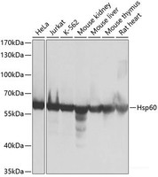 Western blot analysis of extracts of various cell lines using Hsp60 Polyclonal Antibody at dilution of 1:1000.