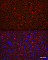 Immunofluorescence analysis of Mouse brain using GAD2 Polyclonal Antibody at dilution of 1:100 (40x lens) . Blue: DAPI for nuclear staining.