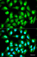 Immunofluorescence analysis of HeLa cells using RAN Polyclonal Antibody