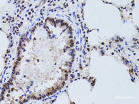 Immunohistochemistry of paraffin-embedded Rat lung using SIRT7 Polyclonal Antibody at dilution of 1:100 (40x lens) .