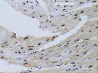 Immunohistochemistry of paraffin-embedded Mouse heart using SIRT7 Polyclonal Antibody at dilution of 1:100 (40x lens) .