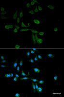 Immunofluorescence analysis of HeLa cells using SIRT7 Polyclonal Antibody