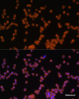 Immunofluorescence analysis of Raw264.7 cells using MyD88 Polyclonal Antibody at dilution of 1:100 (40x lens) . Blue: DAPI for nuclear staining.