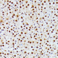 Immunohistochemistry of paraffin-embedded Rat ovary using ID2 Polyclonal Antibody at dilution of 1:100 (40x lens) .