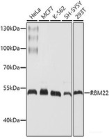 Western blot analysis of extracts of various cell lines using RBM22 Polyclonal Antibody at dilution of 1:1000.