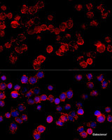 Immunofluorescence analysis of HeLa cells using CYP3A7 Polyclonal Antibody at dilution of 1:100 (40x lens) . Blue: DAPI for nuclear staining.