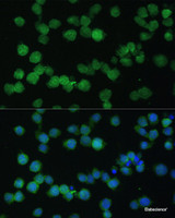 Immunofluorescence analysis of THP-1 cells using CR1 Polyclonal Antibody at dilution of 1:100. Blue: DAPI for nuclear staining.