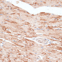 Immunohistochemistry of paraffin-embedded Rat heart using KIR3DL3 Polyclonal Antibody at dilution of 1:100 (40x lens) .