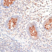Immunohistochemistry of paraffin-embedded Human appendix using KIR3DL3 Polyclonal Antibody at dilution of 1:100 (40x lens) .