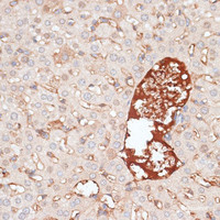 Immunohistochemistry of paraffin-embedded Mouse liver using KIR3DL3 Polyclonal Antibody at dilution of 1:100 (40x lens) .