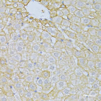 Immunohistochemistry of paraffin-embedded Rat liver using PLA2R1 Polyclonal Antibody at dilution of 1:100 (40x lens) .