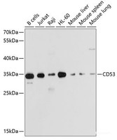 Western blot analysis of extracts of various cell lines using CD53 Polyclonal Antibody at dilution of 1:1000.