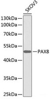 Western blot analysis of extracts of SKOV3 cells using PAX8 Polyclonal Antibody.