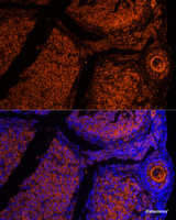 Immunofluorescence analysis of Mouse oophoroma cells using ZP2 Polyclonal Antibody at dilution of 1:100. Blue: DAPI for nuclear staining.