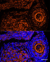 Immunofluorescence analysis of Mouse oophoroma cells using ZP2 Polyclonal Antibody at dilution of 1:100. Blue: DAPI for nuclear staining.
