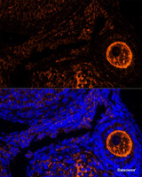 Immunofluorescence analysis of Mouse oophoroma cells using ZP2 Polyclonal Antibody at dilution of 1:100. Blue: DAPI for nuclear staining.