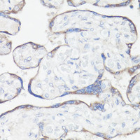 Immunohistochemistry of paraffin-embedded Human placenta using CLUH Polyclonal Antibody at dilution of 1:100 (40x lens) .