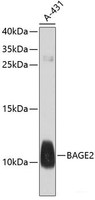 Western blot analysis of extracts of A-431 cells using BAGE2 Polyclonal Antibody at dilution of 1:1000.