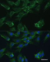 Immunofluorescence analysis of C6 cells using ADA Polyclonal Antibody at dilution of 1:100. Blue: DAPI for nuclear staining.