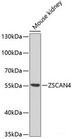 Western blot analysis of extracts of Mouse kidney using ZSCAN4C Polyclonal Antibody at dilution of 1:1000.