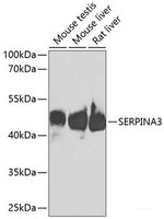Western blot analysis of extracts of various cell lines using SERPINA3 Polyclonal Antibody at dilution of 1:1000.