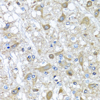 Immunohistochemistry of paraffin-embedded Rat brain using SERPINA3 Polyclonal Antibody at dilution of 1:100 (40x lens) .