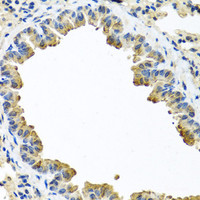 Immunohistochemistry of paraffin-embedded Mouse lung using SERPINA3 Polyclonal Antibody at dilution of 1:100 (40x lens) .