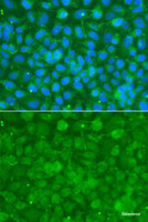 Immunofluorescence analysis of A549 cells using SERPINA3 Polyclonal Antibody
