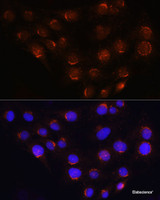 Immunofluorescence analysis of C6 cells using GOLGA4 Polyclonal Antibody at dilution of 1:100 (40x lens) . Blue: DAPI for nuclear staining.