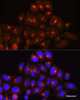 Immunofluorescence analysis of HeLa cells using GOLGA4 Polyclonal Antibody at dilution of 1:100 (40x lens) . Blue: DAPI for nuclear staining.