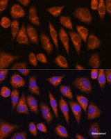 Immunofluorescence analysis of L929 cells using GOLGA4 Polyclonal Antibody at dilution of 1:100 (40x lens) . Blue: DAPI for nuclear staining.