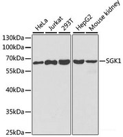 Western blot analysis of extracts of various cell lines using SGK1 Polyclonal Antibody at dilution of 1:1000.