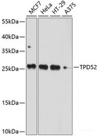 Western blot analysis of extracts of various cell lines using TPD52 Polyclonal Antibody at dilution of 1:1000.