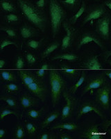 Immunofluorescence analysis of U-2 OS cells using KIF14 Polyclonal Antibody at dilution of 1:100 (40x lens) . Blue: DAPI for nuclear staining.