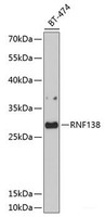 Western blot analysis of extracts of BT-474 cells using RNF138 Polyclonal Antibody at dilution of 1:1000.
