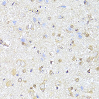 Immunohistochemistry of paraffin-embedded Rat brain using EGLN1/EGLN2 Polyclonal Antibody at dilution of 1:100 (40x lens) .